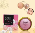 Angel Melasma Cream